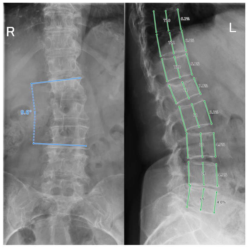 HealthSpine — диагностика позвоночника